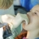 Dentist Applying Staples In Girl Mouth - VideoHive Item for Sale