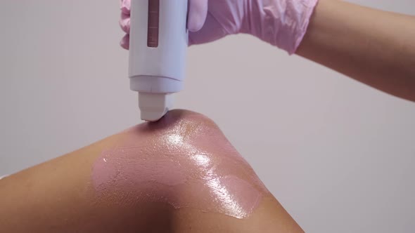 Closeup of Hair Removal Machine Used By Cosmetologist in Salon