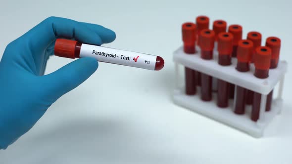 Negative Parathyroid Test, Doctor Showing Blood Sample, Lab Research, Healthcare