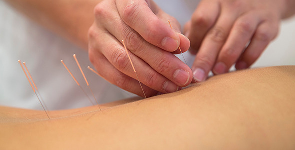 Treatment by Acupuncture