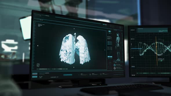 Monitoring System Discovers Covid-19 Causing Pneumonia During Lungs Analysis alt