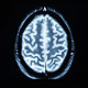 Brain MRI Scan - VideoHive Item for Sale