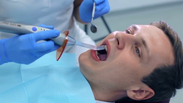 Installation Of Light-curing Fillings