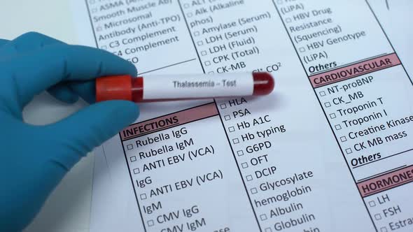 Thalassemia, Doctor Checking Disease in Lab Blank, Showing Blood Sample in Tube