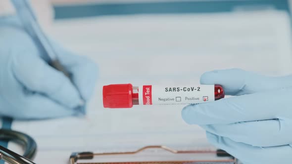 Close Up of Doctors Hand Holding Tube with Positive Blood Test for SARS-CoV-2