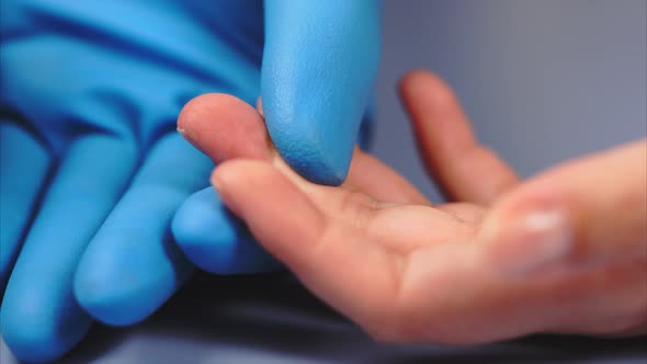 Doctor Using Lancet on Female's Patient Finger. Drop of Blood on Finger.