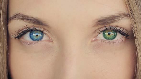 Woman With Blue And Green Eyes- Heterochromia