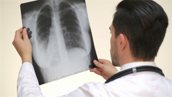 Doctor Examines An X-ray View From The Back alt
