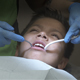 Dental Suction On Kid - VideoHive Item for Sale