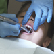 Kid Receives Teeth Polish - VideoHive Item for Sale