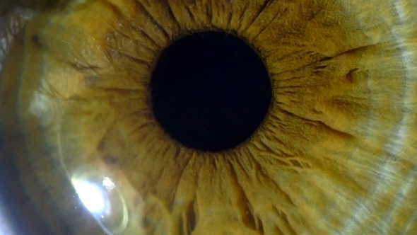 Eye