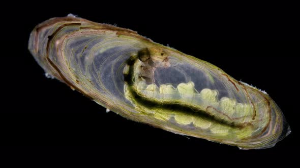 Trichoptera Larva Under a Microscope Family Hydroptilidae