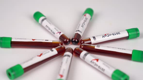 Coronavirus test tubes, flasks in laboratory. Coronavirus positive and negative test results.