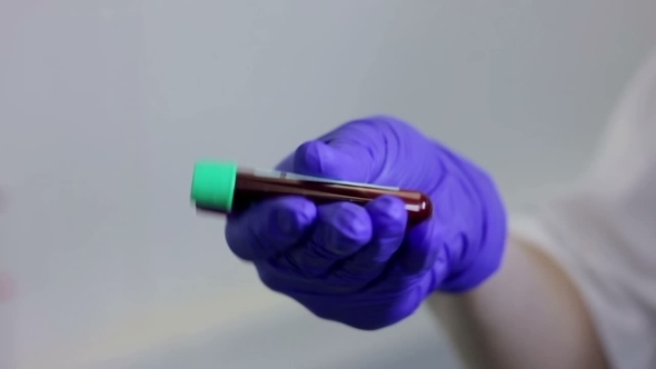 Nurse Shaking Blood In Green Test Tube
