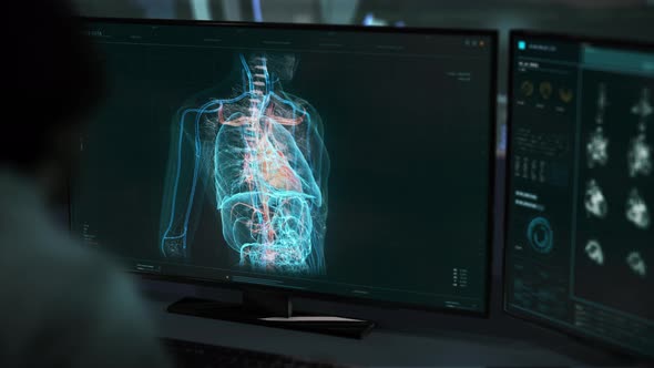 Doctor Uses Futuristic Medical Analysis Interface To Examine Heart Vessels alt