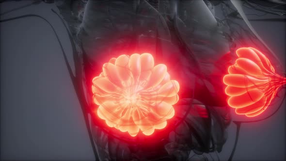 Medically Accurate Illustration of an Obese Womens Mammary Glands alt