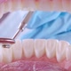 Dentist Inspects Patient's Teeth with Probe and Mirror - VideoHive Item for Sale