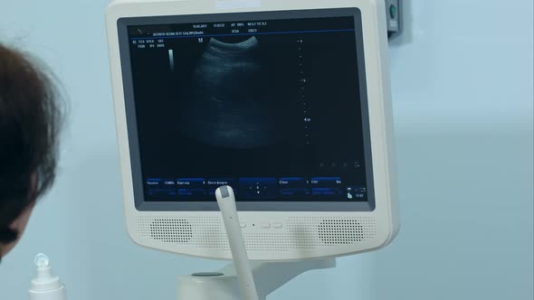 Female Gynecologist Checking Fetal Life with Ultrasound Scanner