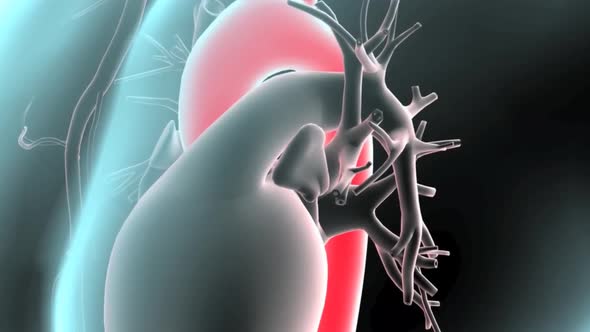 Footage of pulsatile Abdominal Aortic Aneurysm