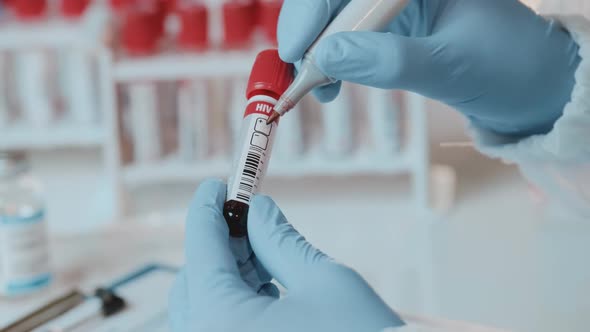 Doctors Hands Holding Positive Blood Sample for Hiv Test. World AIDS Day