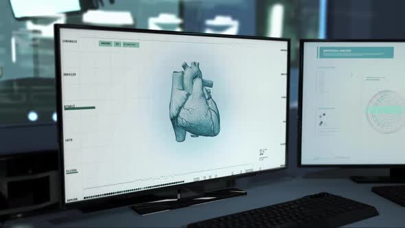 Diagnostic System Scanning Heart Organ To Discover Cardiac Ischemia Disease alt