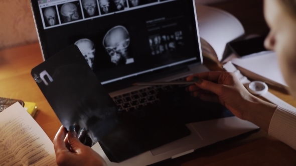 Doctor Looking At X-ray Of The Evening At a Laptop