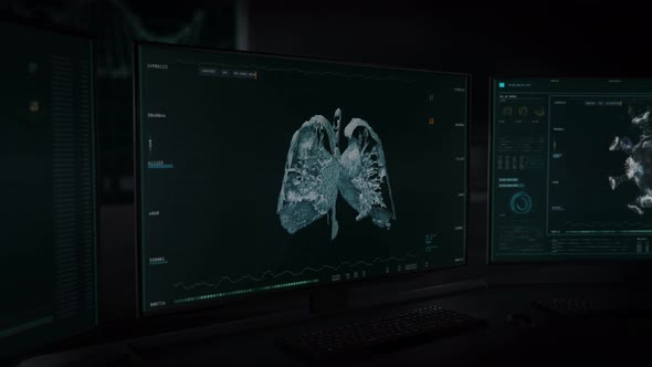 3D Rendering the human lungs. Identifying the Covid-19 Pneumonia inside. alt