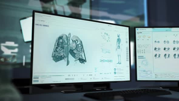 Medical software is scanning the chest to analyze the disease before therapy alt