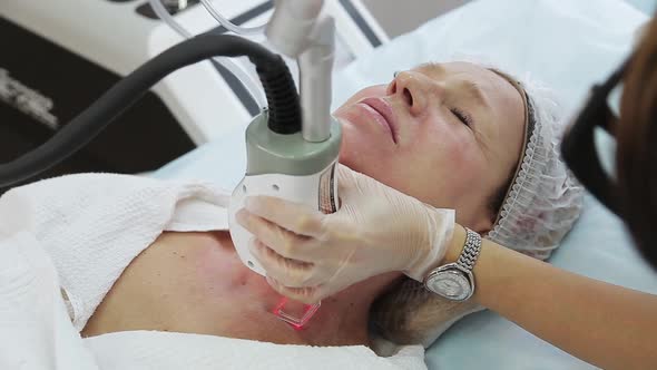 Resurfacing Facial Skin with a Laser