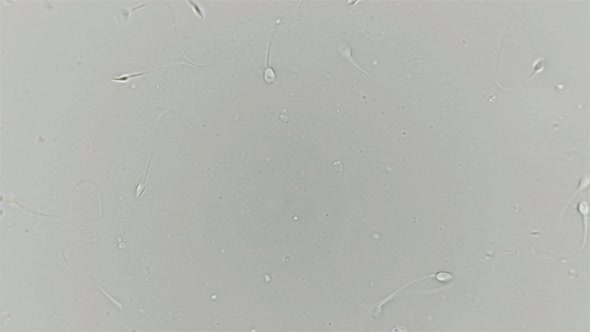 Human sperm under a microscope (spermatozoa)