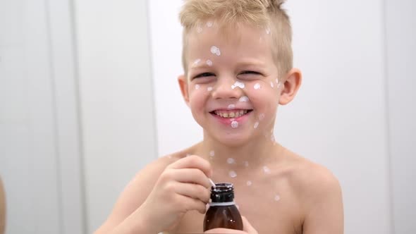 Little Happy Boy with Varicella Virus or Chickenpox Bubble Rash Smiling at Camera