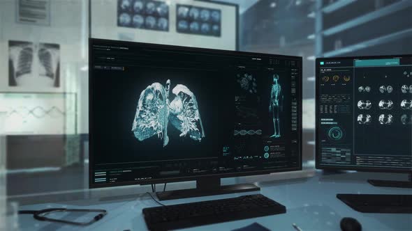 Health Analysis System Detected Dangerous Cancer Illness In Patients Lungs alt