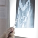 Doctors Discuss Patient X-ray Image - VideoHive Item for Sale