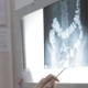 Doctors Discuss Patient X-ray Image - VideoHive Item for Sale