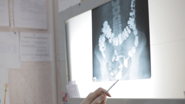 Doctors Discuss Patient X-ray Image