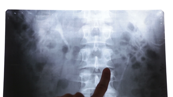 Doctors Regard Chest X-ray
