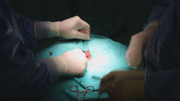 Surgeon Sutures During Surgery 4