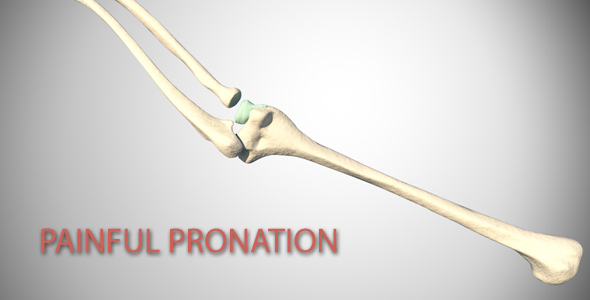Painful Pronation alt