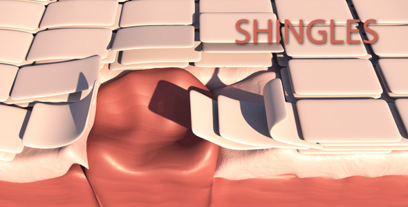 Shingles alt