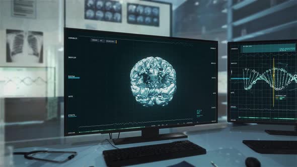 Skull X-Ray Examination Displayed In High-Tech Medical Software At Hospital alt