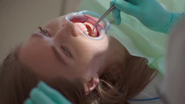 Dentist Making Professional Teeth Cleaning Female Young Patient at the Dental Office. Oral Hygiene