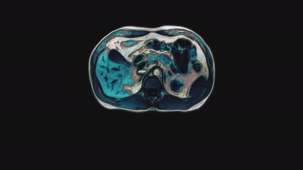 Bulk Multicolored CT Scan of the Abdomen