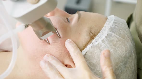 Therapist Makes Laser Hair Removal Procedure on Patient Face