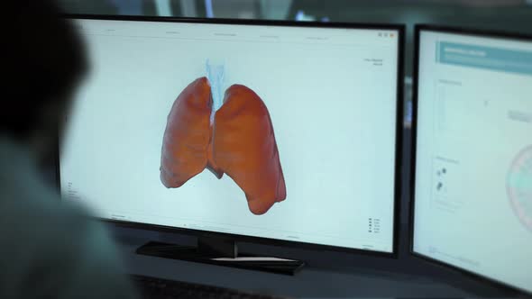 Modern Medical anatomy examination system identifies the lung cancer illness alt
