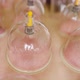 Plastic Medical Cups for Dry Cupping Therapy on Patient Back - VideoHive Item for Sale