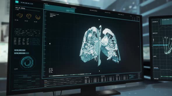 Advanced Medical Software System Ui Conducts Disease Analysis Diagnosis alt