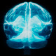 Cool X-ray of the Brain - VideoHive Item for Sale