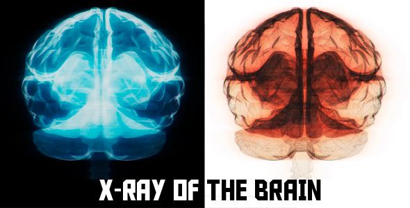 Cool X-ray of the Brain