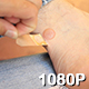 Bandage Reveals Blister on Heel - VideoHive Item for Sale