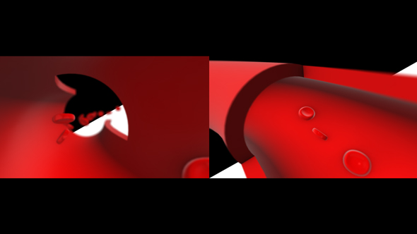 In Blood Vessel Cross Section